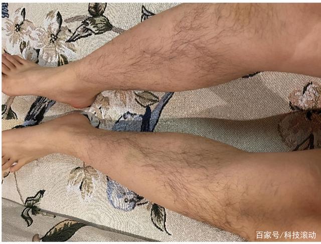 如何腋下脱毛(如何去掉下液的毛)